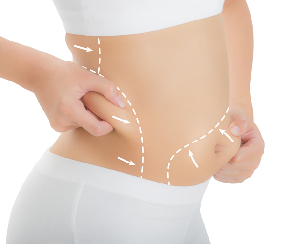 liposuction in ludhiana, punjab